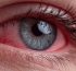 cbd puede poner los ojos rojos